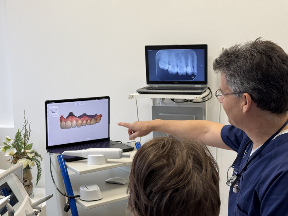 Intraoralscanner